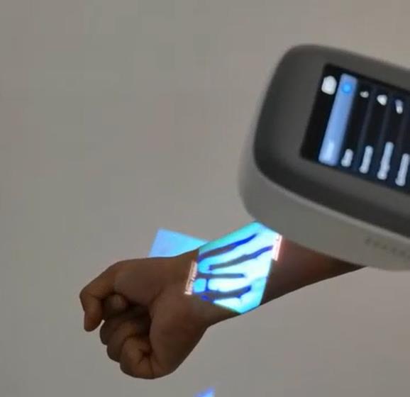 QV-600 Medical Vein Finder Vie - Medical Lab Images reseña y precio